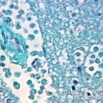 “Ameba come cerebros: amenaza creciente con el cambio climático”