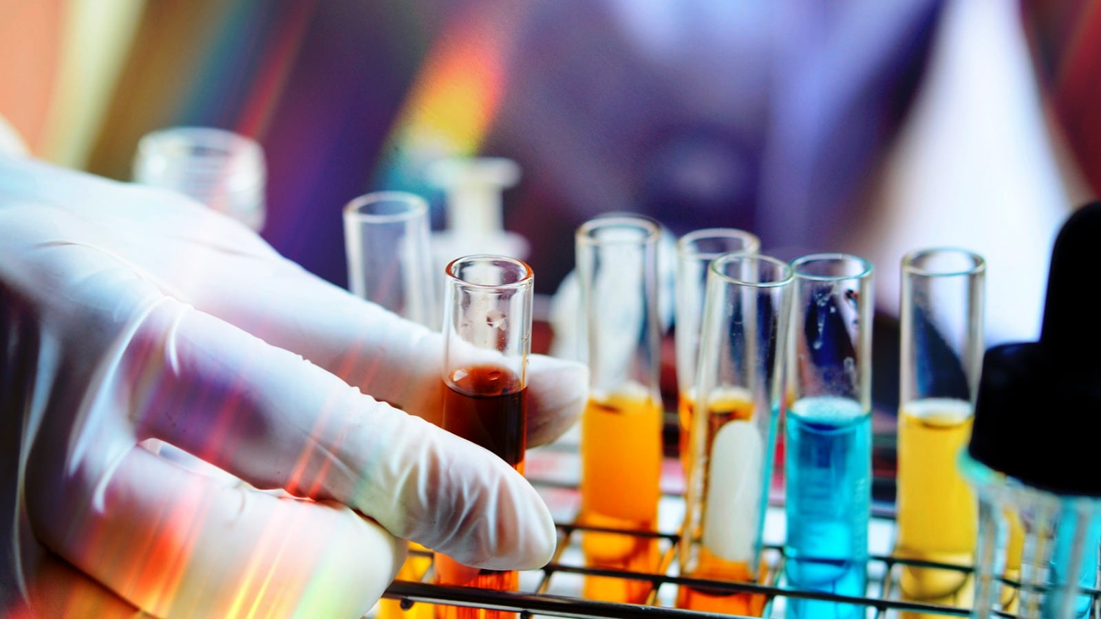 Colores de Orina y su Impacto en la Salud Colores de Orina y su Impacto en la Salud