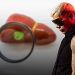 “Samo de Camila: Cirugía de Emergencia y Recuperación” "Samo de Camila: Cirugía de Emergencia y Recuperación"